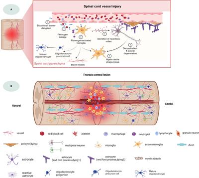 Spatial multi-omics analysis of the microenvironment in traumatic spinal cord injury: a narrative review